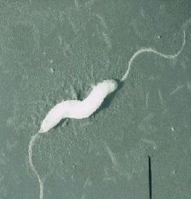Photo:Campylobacter jejuni