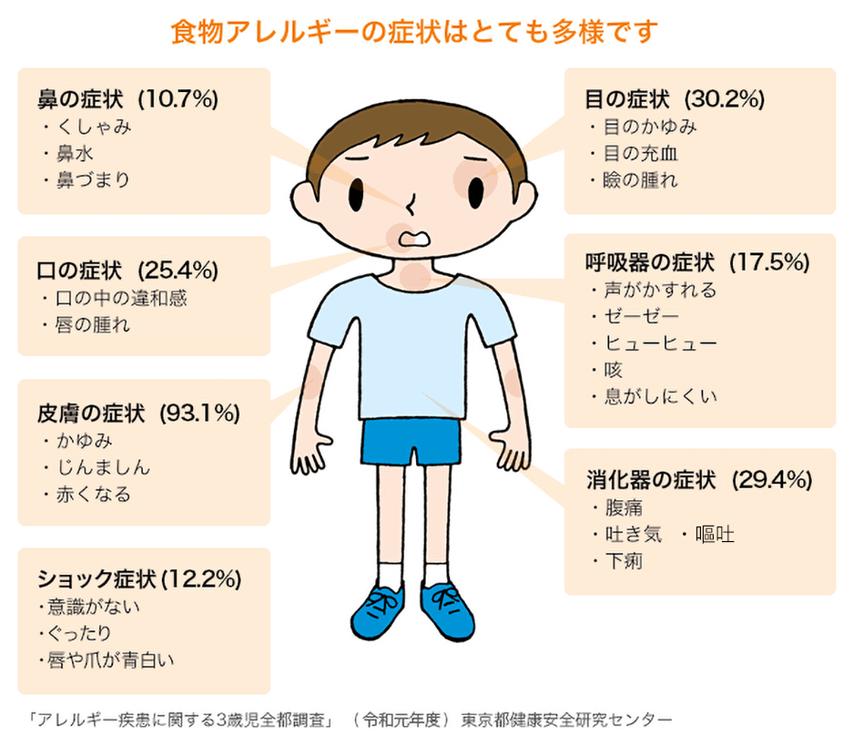 食物アレルギーの症状イラスト