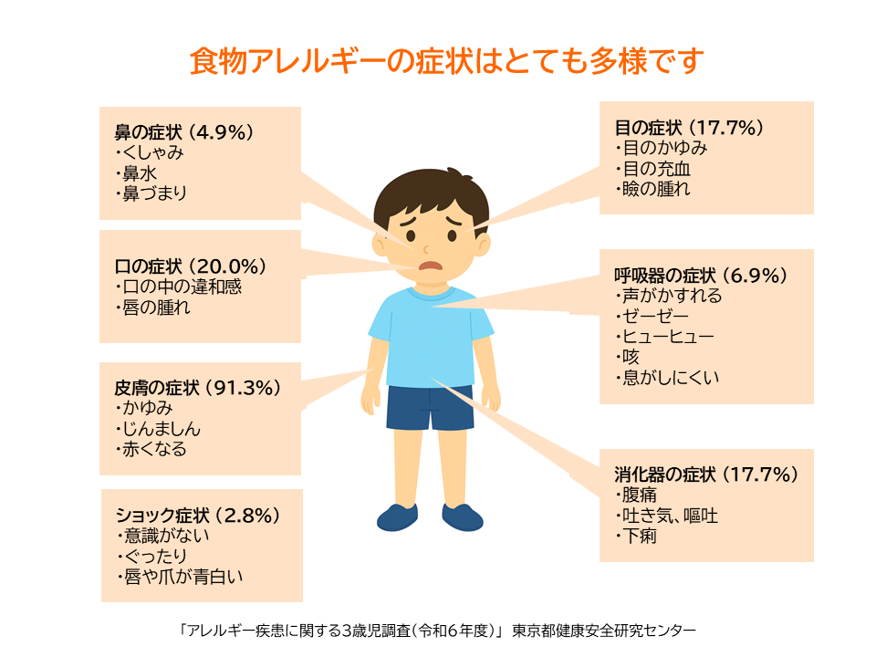 食物アレルギーの症状イラスト