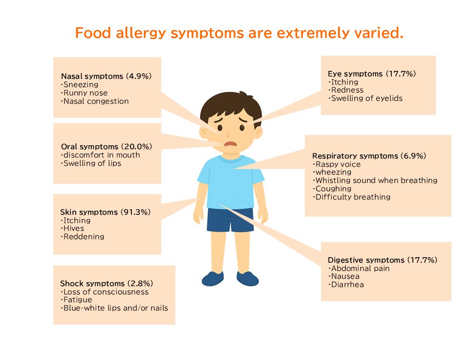 Illustration of food allergy symptoms