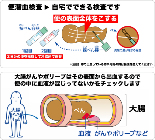 便潜血検査の画像