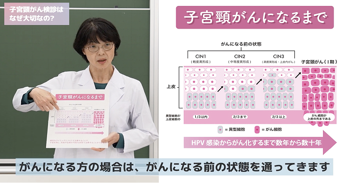 子宮頸がんになるまで がんになる方の場合は、がんになる前の状態を通ってきます