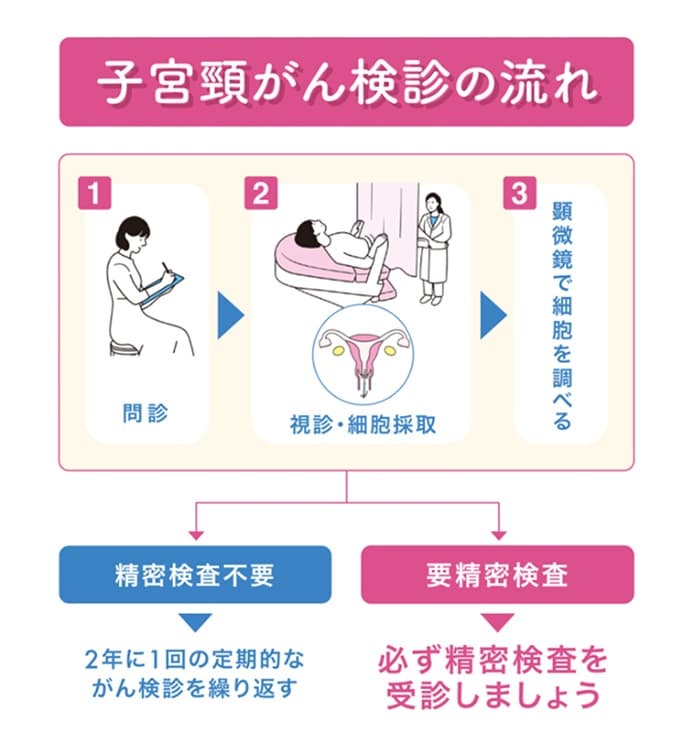 子宮頸がん検診の流れ 1.問診 2.視診・細胞採取 3.顕微鏡で細胞を調べる 精密検査不要→2年に1回の定期的ながん検診を繰り返す 要精密検査→必ず精密検査を受診しましょう