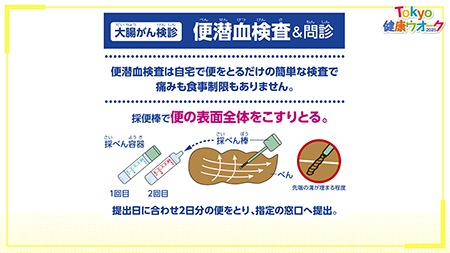 大腸がん検診：便潜血検査の画像