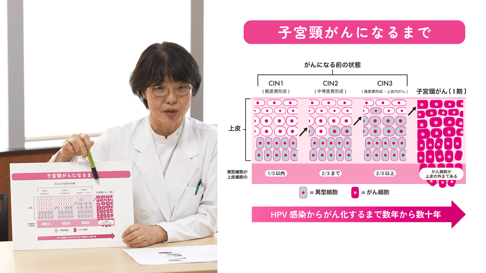 子宮頸がんの早期発見・早期治療の5年生存率は何％？①20~40% ②50~80% ③90%以上