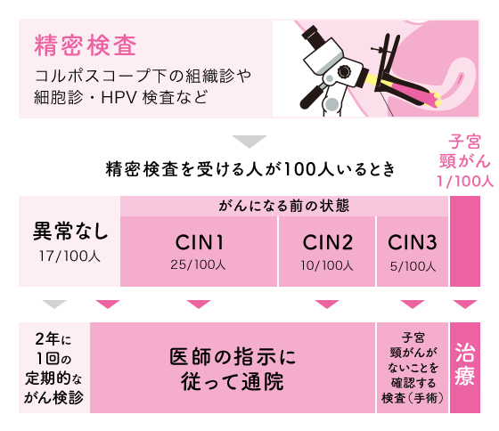 精密検査の流れと大まかな人数比率（コルポスコープ下の組織診や細胞診・HPV検査など）　精密検査を受ける人が100人いるとき　異常なし18人は、2年に1回の定期的ながん検診が望ましい。CIN1・23人、CIN2・8人医師の指示に従って通院が望ましい。、CIN3・4人は、子宮頸がんがないことを確認する検査（手術）を行う。子宮頸がん1人は治療を行う。なお、CINとはがんになる前の状態のこと