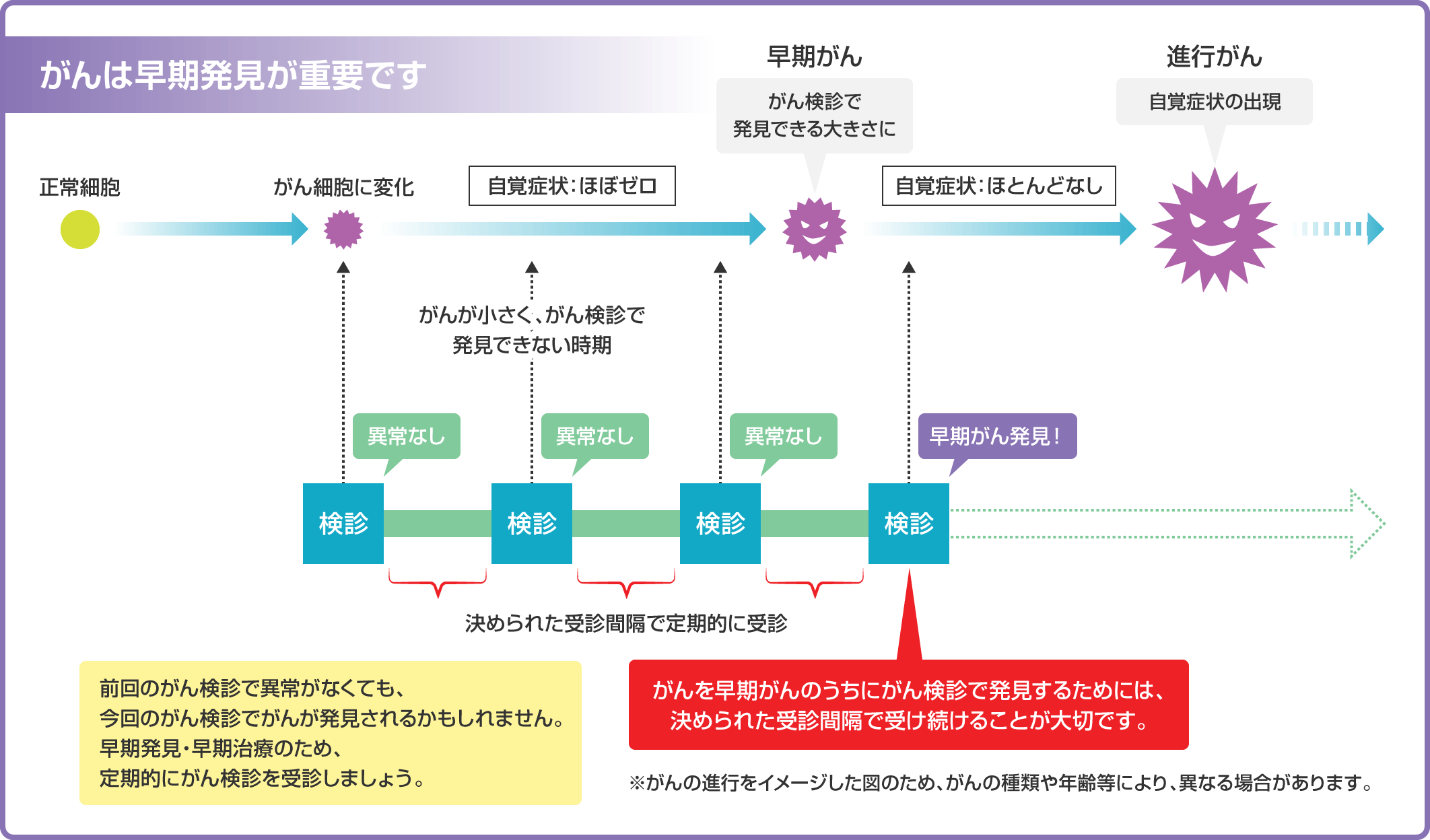 がん進行:イメージ