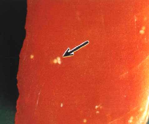 Figure: Cysts of Myxosporidia parasitizing muscle of big-eyed tuna (Cyst: A bag containing spores)